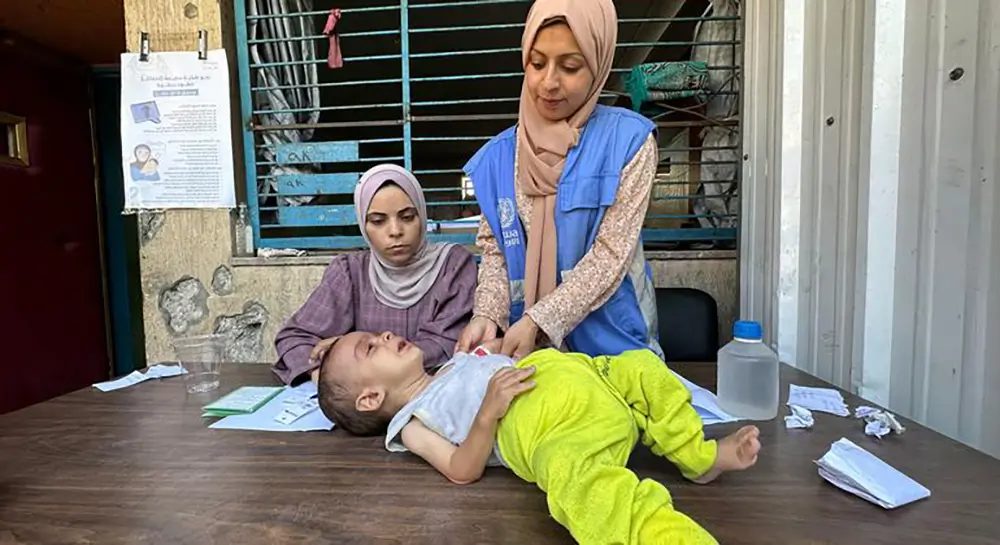 Un niño pequeño es evaluado por desnutrición por una trabajadora de la UNRWA en la ciudad de Gaza.