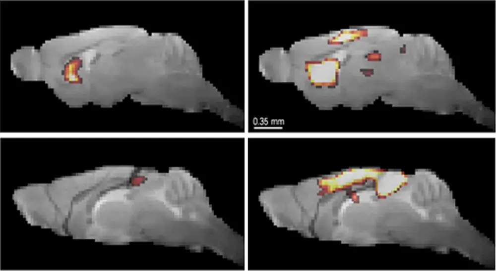 Áreas de baja conectividad (Izda) en cerebro de ratón (modelo de párkinson) vs grupo de control (normal).