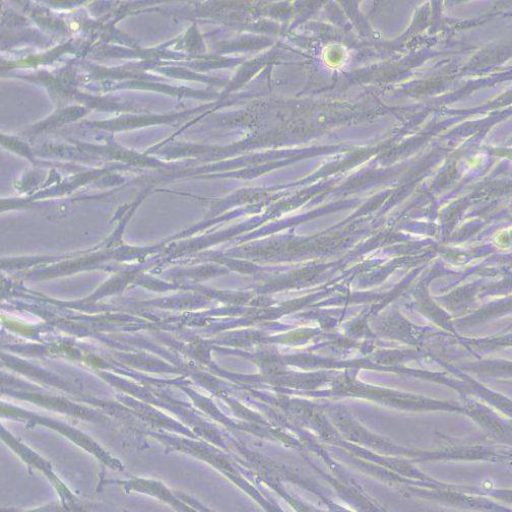 Fibroblastos hepáticos Htert HSC utilizados en el estudio
